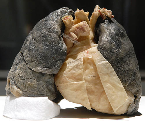 Real Smokers Lungs